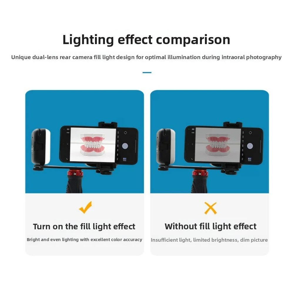 치과 사진 촬영 조명, 스마트폰용 블루투스 LED 플래 - Photography Lighting Kit 리뷰 및 가격